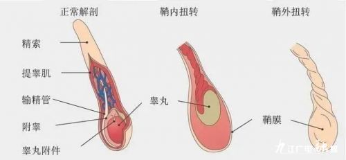 提睾肌紧张图片